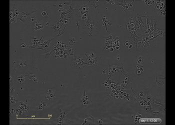 AI 과학 조수, 신약 재배치 성공… 구글 '코사이언티스트' 등 논문 발표