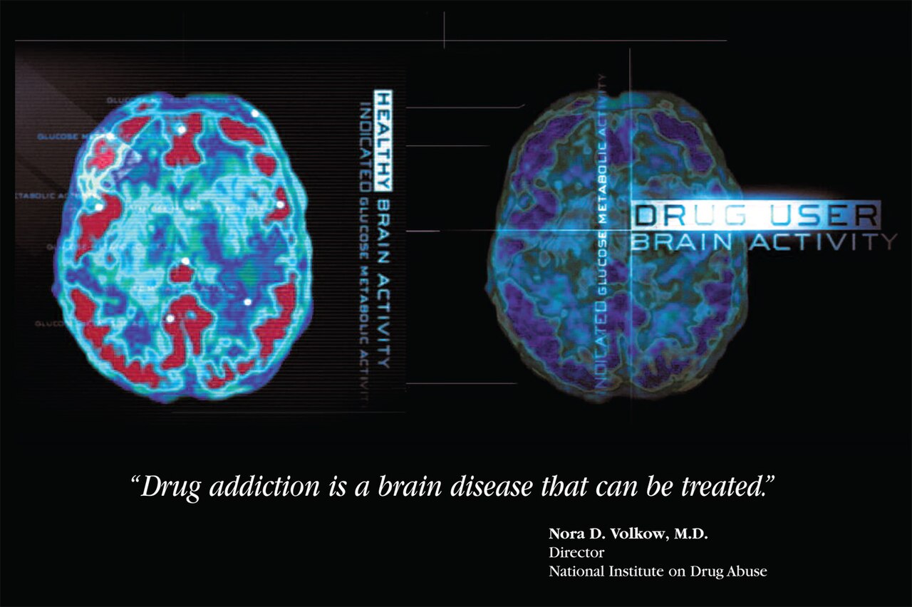 Drug Brain Activity