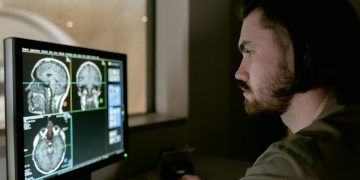 Radiologist examining a CT scan on a monitor in a medical facility.