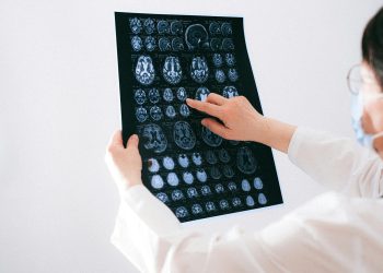 Doctor examines brain MRI scans closely for medical diagnosis in a hospital environment.