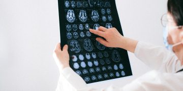 Doctor examines brain MRI scans closely for medical diagnosis in a hospital environment.