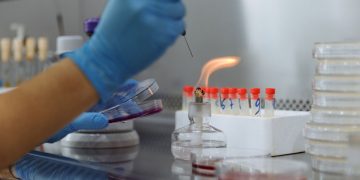 Close-up of a scientist conducting an experiment with petri dishes and a Bunsen burner in a laboratory.
