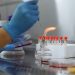 Close-up of a scientist conducting an experiment with petri dishes and a Bunsen burner in a laboratory.
