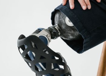 A detailed close-up of a prosthetic leg showcasing innovative technology and design.