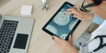 Doctor examining brain scan on tablet at desk.