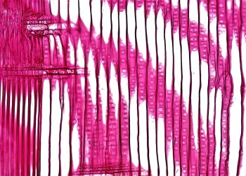 Close-up of a stained plant stem section, showcasing cellular structure under a microscope.