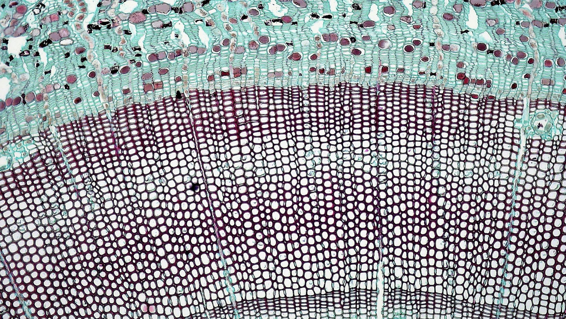 Detailed image of plant tissue cross-section showing cellular structure under microscope.
