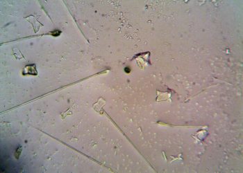 Detailed view of various particles under a microscope, showcasing shapes and textures.