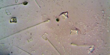 Detailed view of various particles under a microscope, showcasing shapes and textures.