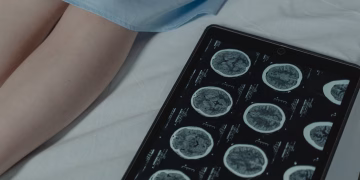 Close-up of brain CT scan display on tablet beside patient's legs in a hospital room.