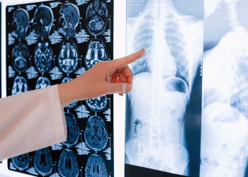 A doctor pointing at a chest X-ray among MRI scans in a medical clinic.