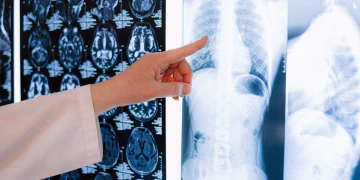 A doctor pointing at a chest X-ray among MRI scans in a medical clinic.