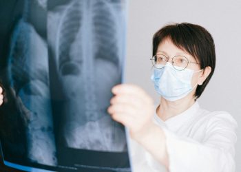 A doctor examines a chest X-ray in a clinical setting, highlighting medical diagnostics.