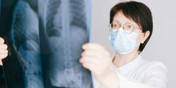 A doctor examines a chest X-ray in a clinical setting, highlighting medical diagnostics.