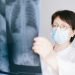A doctor examines a chest X-ray in a clinical setting, highlighting medical diagnostics.