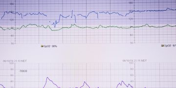 lifeline on white paper