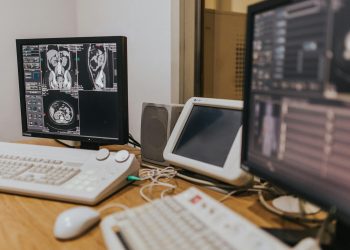 Medical imaging setup with MRI scans on multiple screens in a healthcare facility.