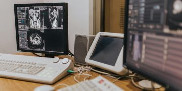 Medical imaging setup with MRI scans on multiple screens in a healthcare facility.