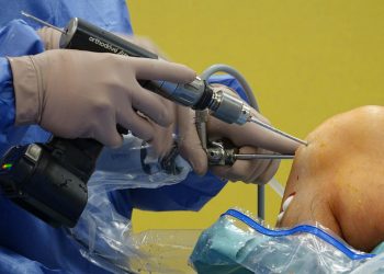 Orthopedic surgeon using equipment during knee arthroscopy in the operating room.