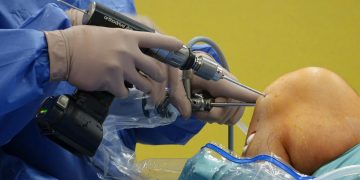 Orthopedic surgeon using equipment during knee arthroscopy in the operating room.