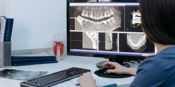 Dentist examining dental X-rays on a computer screen in a clinic.