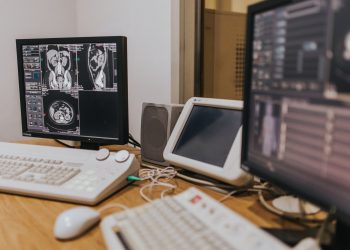 Medical imaging setup with MRI scans on multiple screens in a healthcare facility.