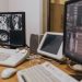 Medical imaging setup with MRI scans on multiple screens in a healthcare facility.