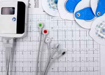 Close-up of ECG device with leads and electrodes on printed heart rate graph, showcasing medical technology.