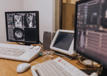 Medical imaging setup with MRI scans on multiple screens in a healthcare facility.