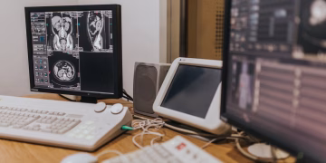 Medical imaging setup with MRI scans on multiple screens in a healthcare facility.