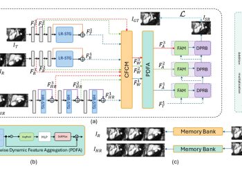 저해상도 심장 MRI 슬라이스 사이 복원한다…참조·메모리 활용 STRMSR 논문 원문에 수록된 연구 도식