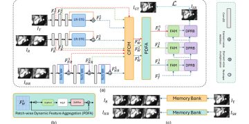 저해상도 심장 MRI 슬라이스 사이 복원한다…참조·메모리 활용 STRMSR 논문 원문에 수록된 연구 도식