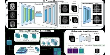 조영제 없이 뇌 MRI 조영 영상 만든다…해부학 인식 AA-ViT 제안 논문 원문에 수록된 연구 도식