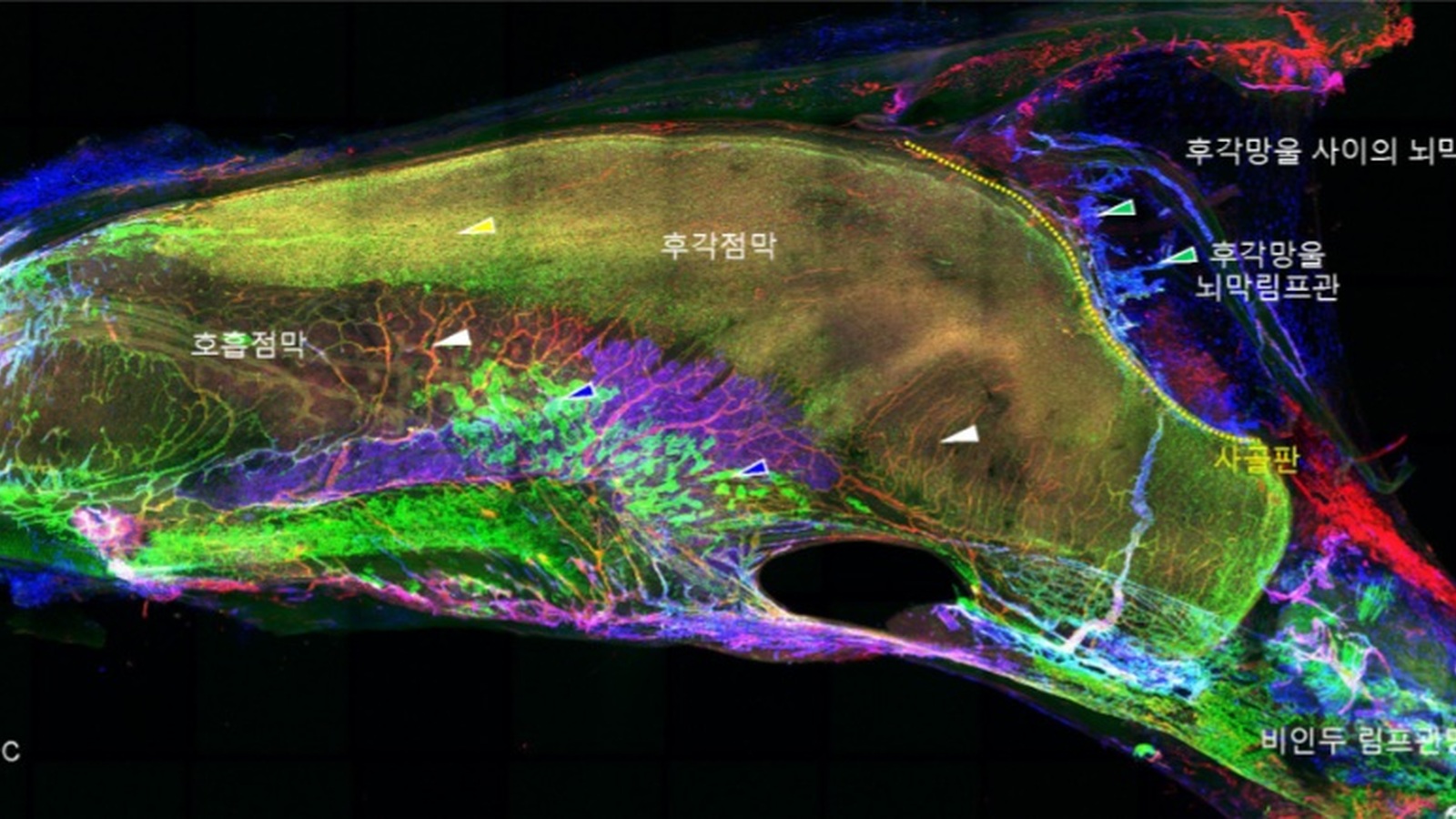 뇌척수액 배출 통로 지주막 소창을 보여주는 IBS 연구진의 형광 현미경 이미지