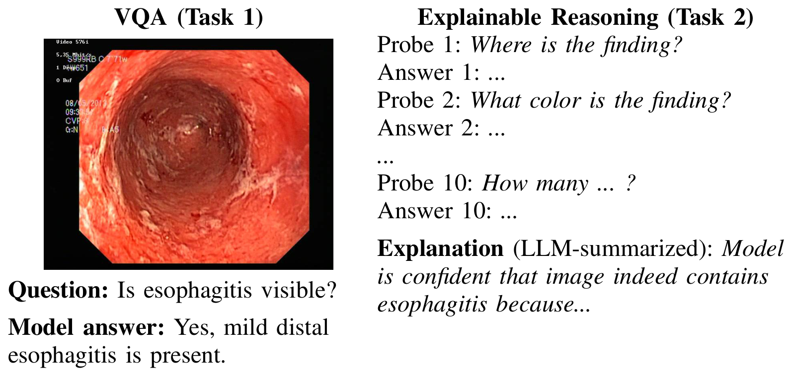 미디어에발 Medico 2025 9개 시스템 비교로 본 신뢰 가능한 다중모달 VQA 설계 원칙 논문의 Figure 1