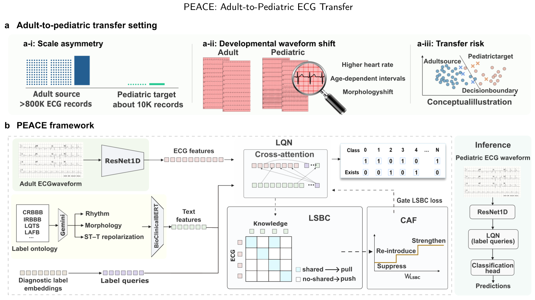 성인 ECG 표현과 라벨 조건 지식을 결합해 소아 ECG로 전이하는 PEACE 구조
