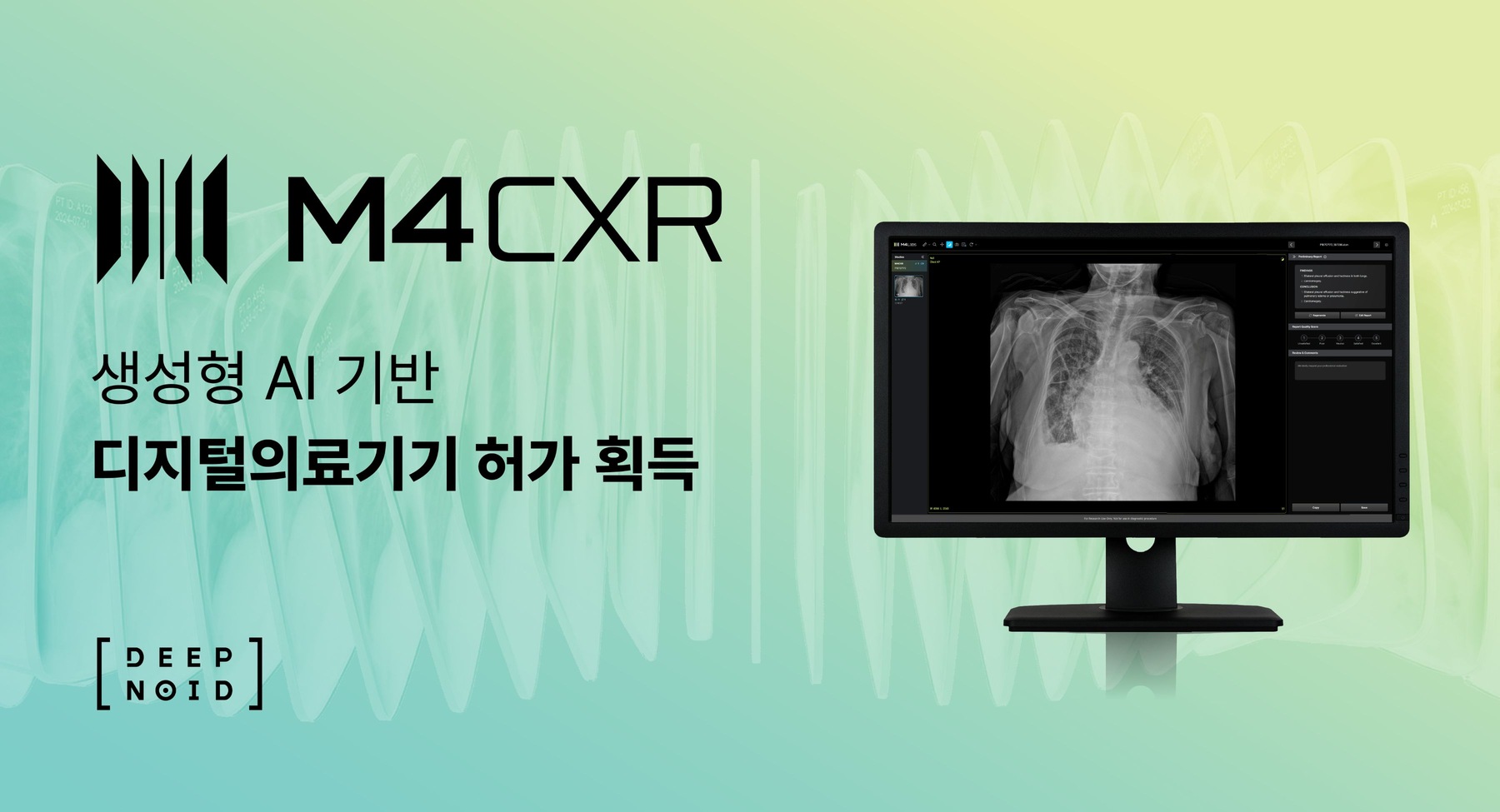 딥노이드 M4CXR, 식약처 3등급 품목허가 확보… 흉부 X-ray 예비소견서 생성 관련 공식 발표 시각자료